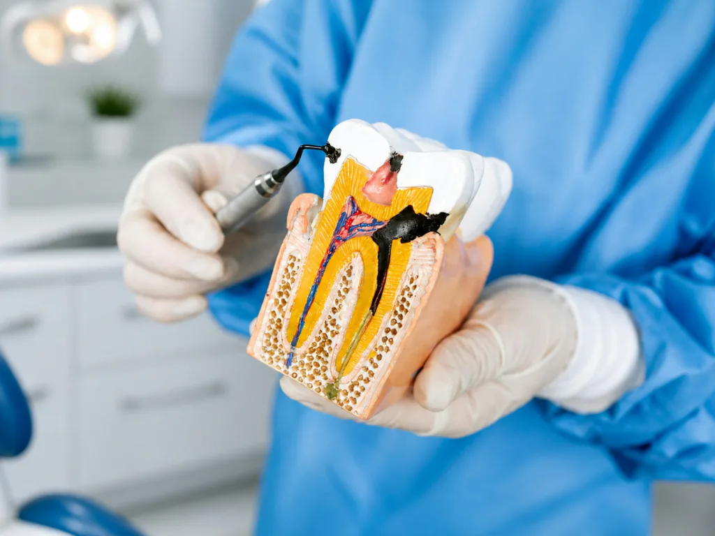 A dentist holding a cross-section model of a tooth, showing decay reaching the nerve